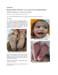 Richner-Hanhart Syndrome: A case report of an 11 month old female