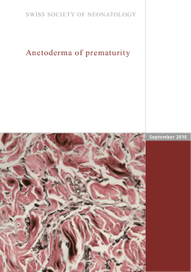 Anetoderma of prematurity - Swiss Society of Neonatology