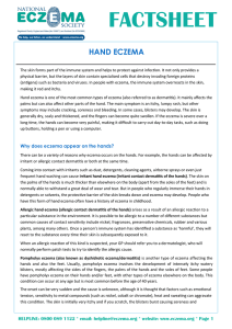 factsheet - National Eczema Society