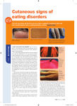 Cutaneous signs of eating disorders