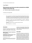 Subcutaneous granuloma annulare presented as