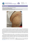 Acute Generalized Exanthematous Pustulosis