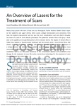 An Overview of Lasers for the Treatment of Scars R