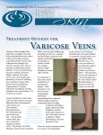 Varicose Veins Atlanta Dermatology, Vein &amp; Research Center, LLC