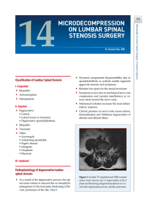 MiCrodeCoMpression on luMbar spinal stenosis surgery