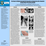 First Report of Multiple Branchial Cleft Anomalies in Conjunction