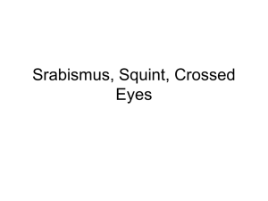 Srabismus, Squint, Crossed Eyes