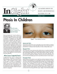 Ptosis In Children Ptosis In Children