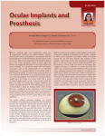 Ocular Implants and Prosthesis