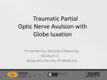 Traumatic partial optic nerve avulsion with luxated globe