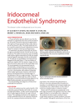 Iridocorneal Endothelial Syndrome