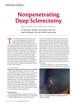 Nonpenetrating Deep Sclerectomy