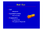 Red Eye