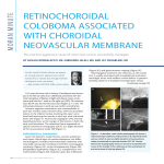 RETINOCHOROIDAL COLOBOMA ASSOCIATED WITH