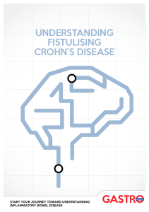 understanding fistulising crohn`s disease