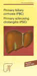 Primary biliary cirrhosis (PBC)