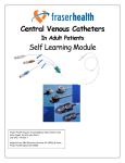 Central Venous Catheters SLP