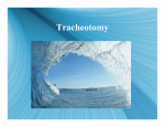 Tracheotomy - UCLA Head and Neck Surgery
