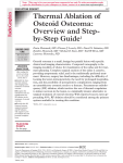 Thermal Ablation of Osteoid Osteoma: Overview and Step