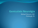Geniculate Neuralgia