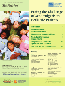 Facing the Challenge of Acne Vulgaris in Pediatric Patients