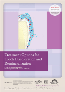 Treatment Options for Tooth Discoloration and Remineralization