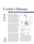Crohn`s Disease