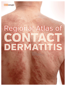Regional Atlas of Contact Dermatitis Now