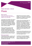 Ptosis - Moorfields Eye Hospital