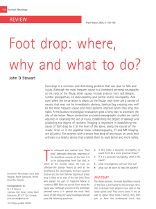 Foot drop: where, why and what to do? - Practical Neurology