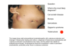 Question What is the most likely diagnosis? Cat scratch disease