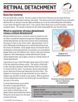 retinal detachment - Retina Consultants of Houston