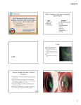 CASE Herpes Simplex Keratitis: Clinical Features