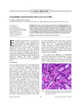 Eosinophilic Gastroenteritis with Ascites in a Child