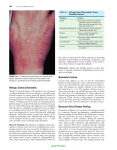 Allergic Contact Dermatitis Nummular Eczema Recurrent Focal