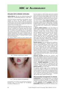 DEALING WITH CHRONIC URTICARIA
