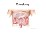 COLOSTOMY 1 2121