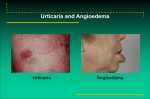 Urticaria and Angioedema