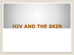 HIV AND THE SKIN Seborrhoeic dermatitis