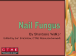 Nail Fungus Presentation