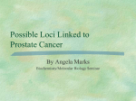 Prostate Cancer - University of Wisconsin–Eau Claire