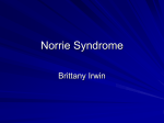 Norrie Syndrome - Bellarmine University