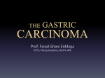 Gastric Cancer