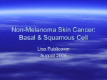 Non-Melanoma Skin Cancer: Basal & Squamous Cell