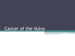 Cancer of the Vulva