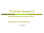 Contact lenses-2