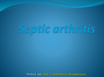 Septic arthritis