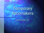 Temporary Pacemakers - University of California, San Diego