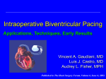 Cardiac Resynchronization for the Implanter