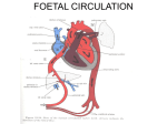 ATRIAL SEPTAL DEFECT